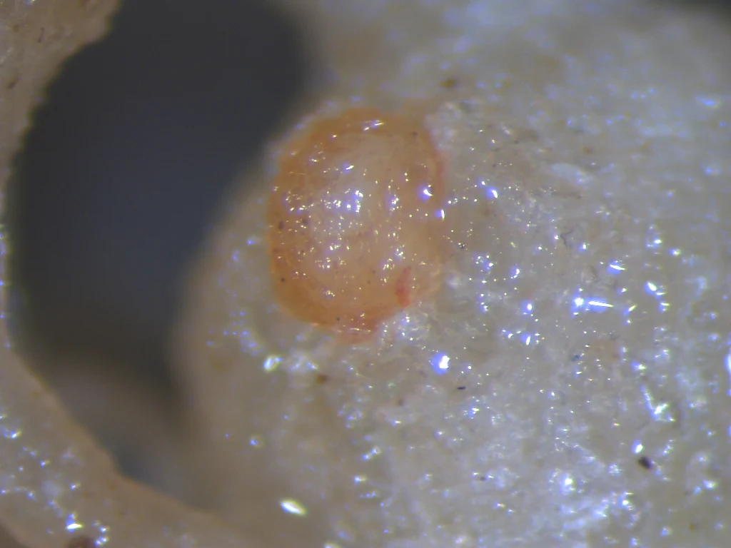 A magnified gelatinous egg mass on the root surface, identified by the source as Meloidogyne incognita.