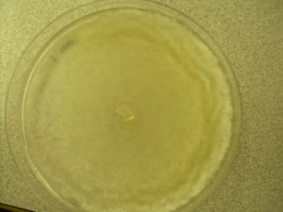 绿色木霉（Trichoderma viride）培养皿中的菌落。